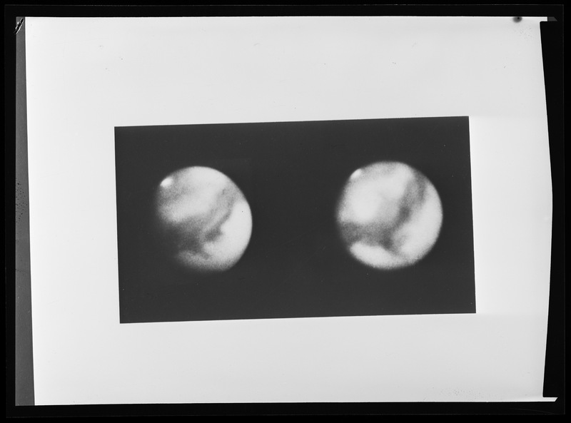 MARS. Filtre rouge. Télescope 60 pouces. Cliché Hale. Observatoires Mt Wilson et Mt Palomar. à gauche : 4 octobre 1909 à droite : 3 novembre 1909 ( forgé)